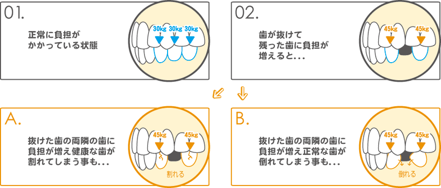 周りの歯がどんどん悪くなっていく可能性。